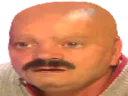 :risitas_chauve_cancer: