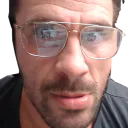 ManuelPhimosis