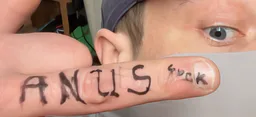 :Anusterix: