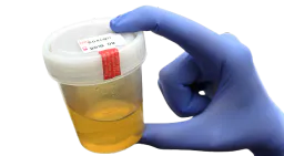 :Urine: