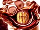 :gnnniii:
