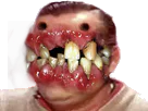 :risidentition: