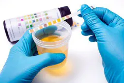 :Analyse_Urine: