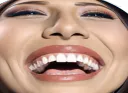 :mqrire5: