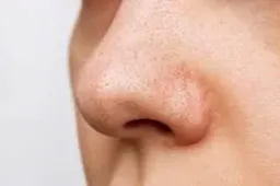 :Nezoz: