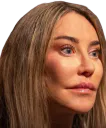 :botox2: