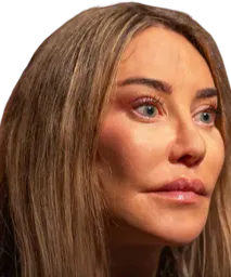 :botox2: