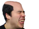 :Kirby54Calvitie: